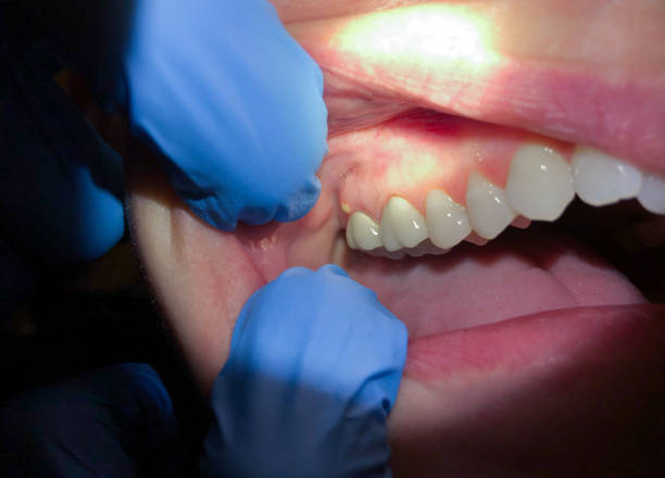Best Broken or Cracked Tooth Emergency Dentist in Madison, WI