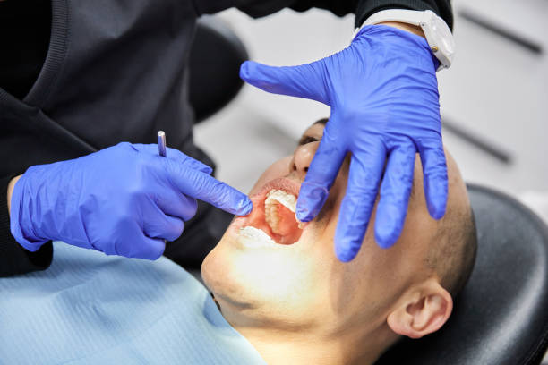 Best Emergency Root Canal Treatment in Madison, WI